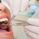 preventief tandarts consult